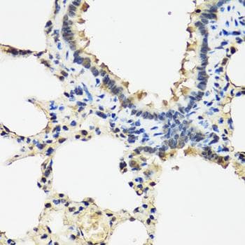 ARSF / Arylsulfatase F Antibody