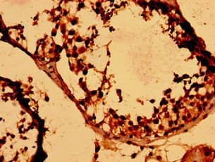 Polyclonal Rabbit anti-Human HIST1H2BK Antibody