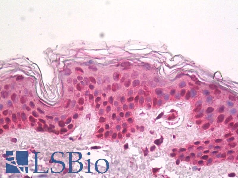 IHC-plus™ Polyclonal Rabbit anti-Human HIRIP3 Antibody (IHC, WB)