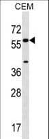 Polyclonal Rabbit anti-Human CYP21A2 Antibody (aa160-188, WB)