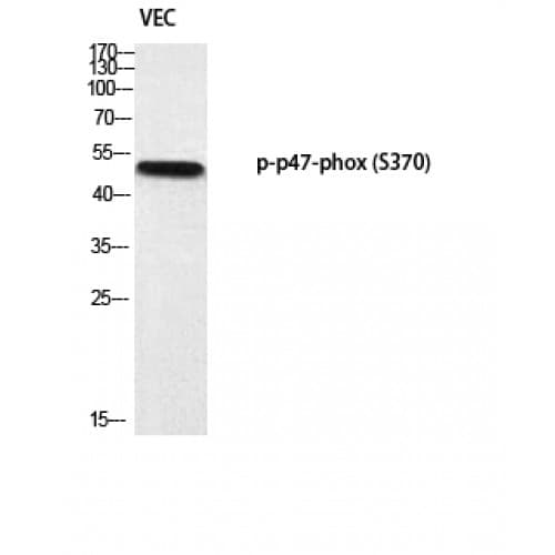 NCF1 / p47phox / p47 phox Antibody (310-390 aa)