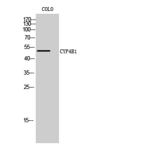 CYP4B1 Antibody (110-190 aa, Internal)