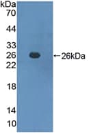 Mouse SOCS3 Protein (Recombinant His, N-Terminal)