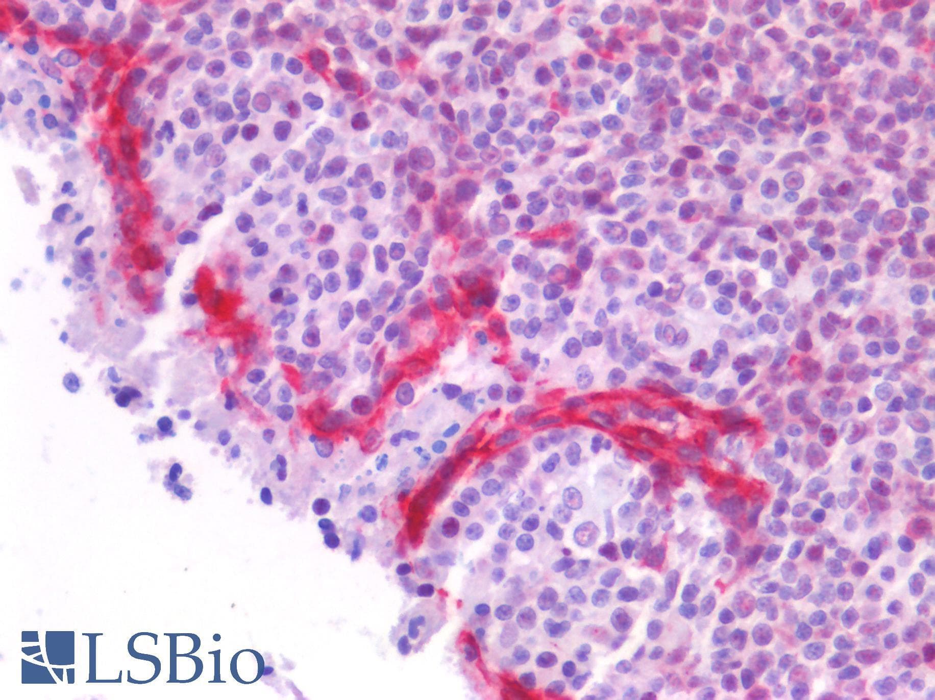 PathPlus™ FOXO1 / FKHR Antibody