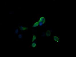 MAP2K3 / MEK3 / MKK3 Antibody (clone OTI3C8)