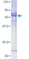 Human RNF126 Protein (Recombinant GST)