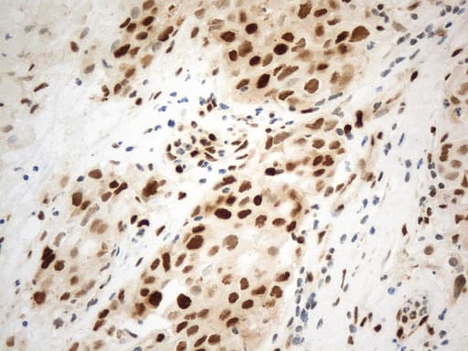 Monoclonal Mouse anti-Human PCNA Antibody (clone UMAB278, Carrier-free, IHC)