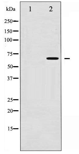CHEK2 / CHK2 Antibody (phospho-Thr387)