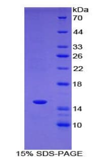 Rat TBX3 Protein (Recombinant His)