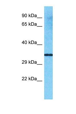 VN1R4 Antibody (aa192-241)