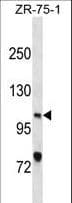 XPC Antibody (aa154-183)