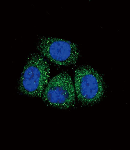 Polyclonal Rabbit anti-Human SCNN1A / ENaC Alpha Antibody (aa365-391, IHC, IF, WB)