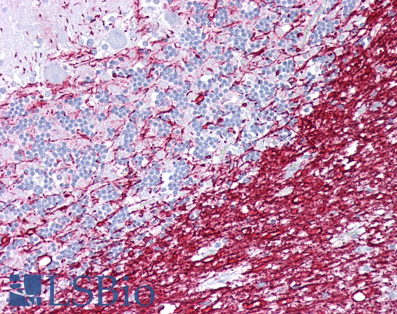 Polyclonal Rabbit anti-Human PLP1 / Myelin PLP Antibody (aa36-85, IHC, WB)