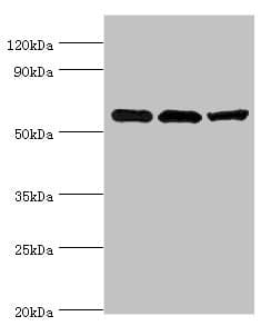 IHC-plus™ ALDH1B1 Antibody (aa278-517)