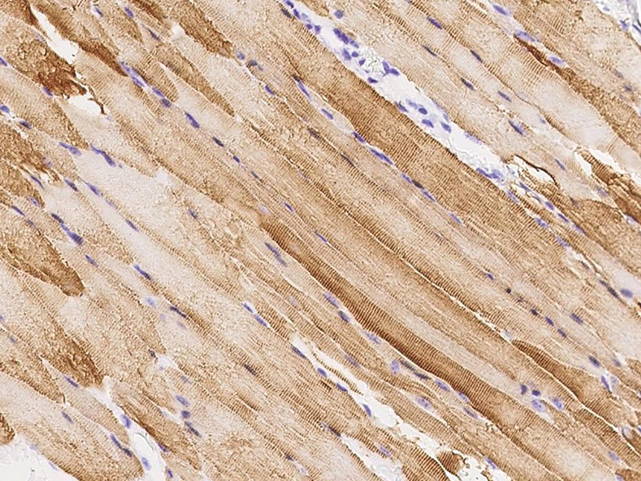 TPM2 Antibody (Preservative Free)