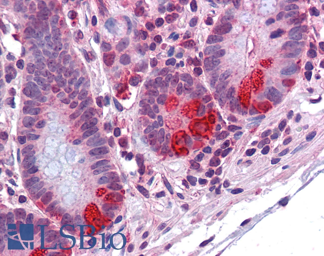 IHC-plus™ PDIA2 Antibody (aa337-348)