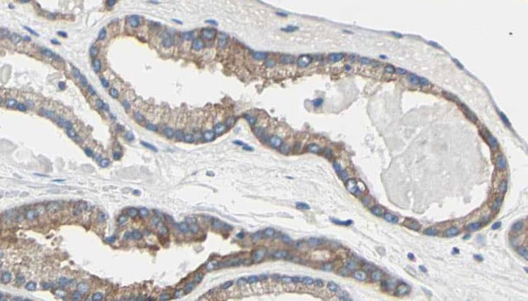 TNNI3 / Cardiac Troponin I Antibody