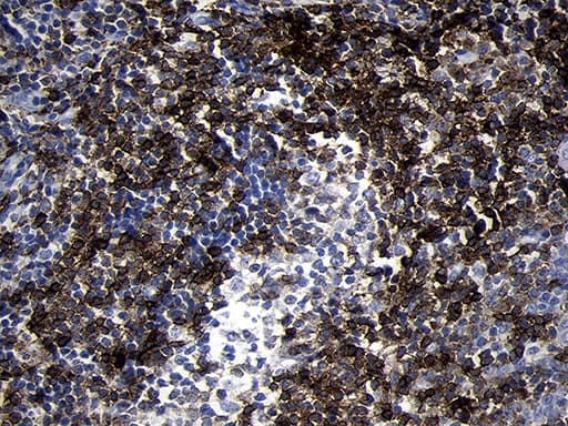 CD79B / CD79 Beta Antibody (clone OTI8A12, Carrier-free)