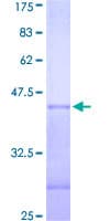 Human PRPF4B Protein (Recombinant GST, N-terminus)