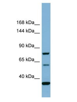 Polyclonal Rabbit anti-Human MYO16 Antibody (aa258-307, WB)