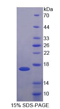 Human UQCRB Protein (Recombinant His-T7)