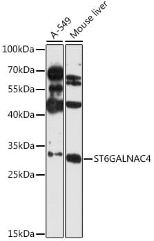 Polyclonal Rabbit anti-Human ST6GALNAC4 Antibody (WB)