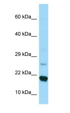 RPS17 / Ribosomal Protein S17 Antibody (aa70-119)