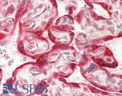 PathPlus™ Polyclonal Rabbit anti-Human GPC3 / Glypican 3 Antibody (IHC, WB)