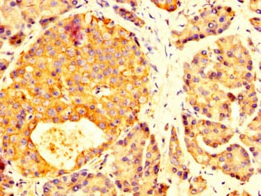 Polyclonal Rabbit anti-Human MYOC / Myocilin Antibody (IHC, WB)