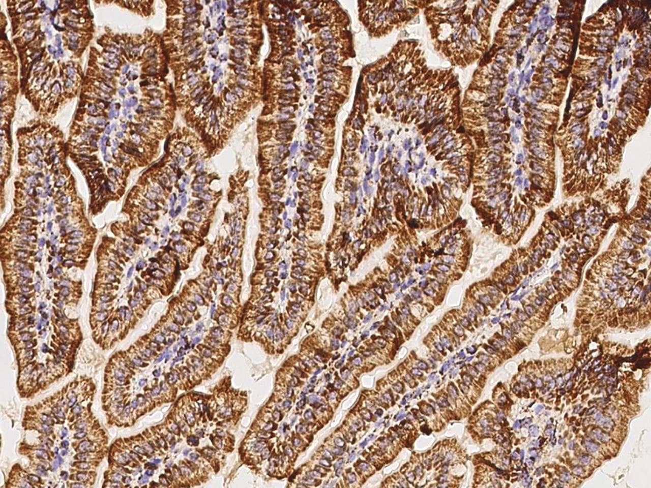 GC1qR / C1QBP Antibody (Preservative Free)