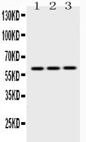 KRT14 / CK14 / Cytokeratin 14 Antibody