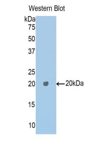 CPE / Carboxypeptidase E Antibody (aa318-476)