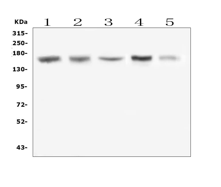 CML / BCR Antibody