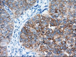IGF2BP2 Antibody (clone OTI3C8)