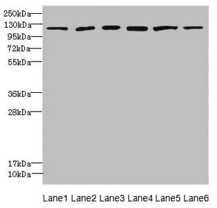 E4 / UBE4A Antibody