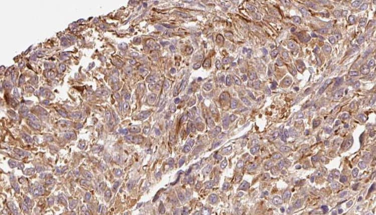 Polyclonal Rabbit anti-Human CMTM7 / CKLFSF7 Antibody (IHC, WB)