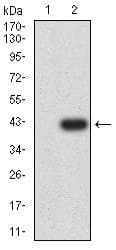 SSTR2 Antibody (clone 6H9D2)
