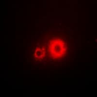 HTR3A / 5-HT3A Receptor Antibody