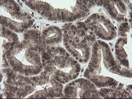 OTUB1 / OTU1 Antibody (clone OTI2H1, Carrier-free)