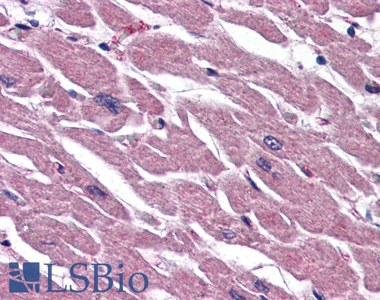 IHC-plus™ Polyclonal Rabbit anti-Human UIMC1 / RAP80 Antibody (IHC, IF, WB)
