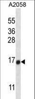 Polyclonal Rabbit anti-Human TEX261 Antibody (aa148-176, IHC, WB)