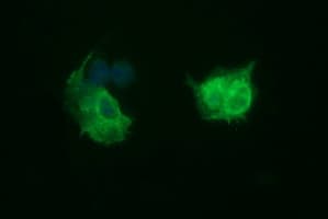 TUBB2B / Tubulin Beta 2B Antibody (clone OTI8F12)