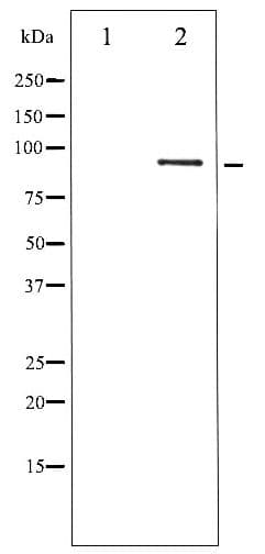 STAT5B Antibody (phospho-Ser731)