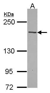 TNS2 / TENC1 Antibody (aa1088-1409)