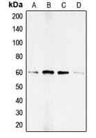 Polyclonal Rabbit anti-Human SMAD1 Antibody (phospho-Ser187, IHC, WB)