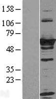 Human RTKN / Rhotekin Protein (Over-Expression Lysate Myc-DDK (Flag))