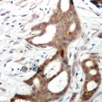 Polyclonal Rabbit anti-Human RPS6KA5 / MSK1 Antibody (phospho-Ser212, IHC, WB)