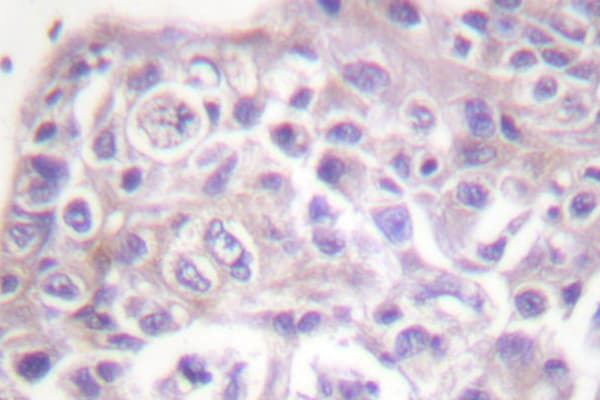 Polyclonal Rabbit anti-Human FOXO1 / FKHR Antibody (Thr323, IHC, IF, WB)