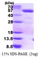 Human PCYT2 / ET Protein (Recombinant His)