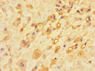 Polyclonal Rabbit anti-Human CA11 / Carbonic Anhydrase XI Antibody